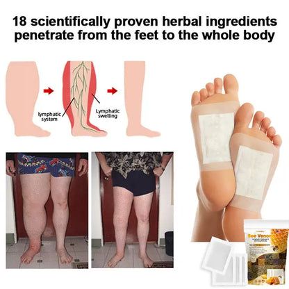 Bee Venom  Drainage Foot Patches Buy 1 Get 1 Free🌿👣